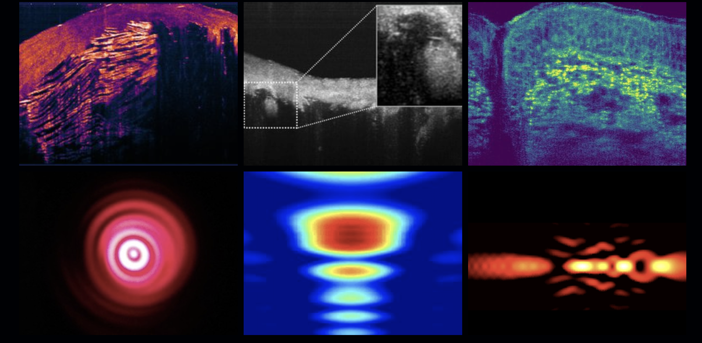 Developing a hololens for surgeons
